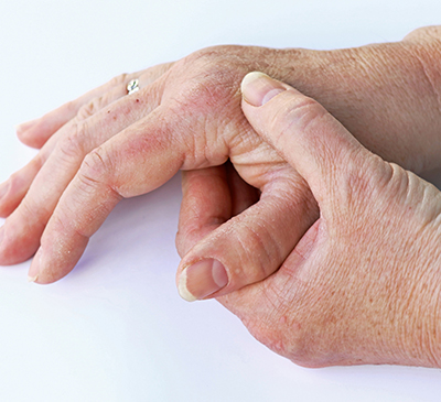 Psoriatic Arthritis - A Pipeline Analysis Report